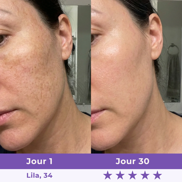 New Sculpteur Facial LED 7-en-1