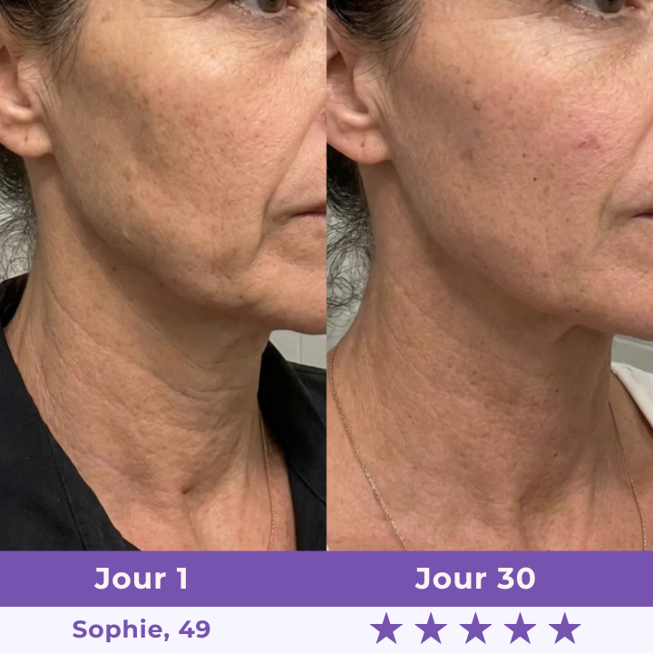 New Sculpteur Facial LED 7-en-1