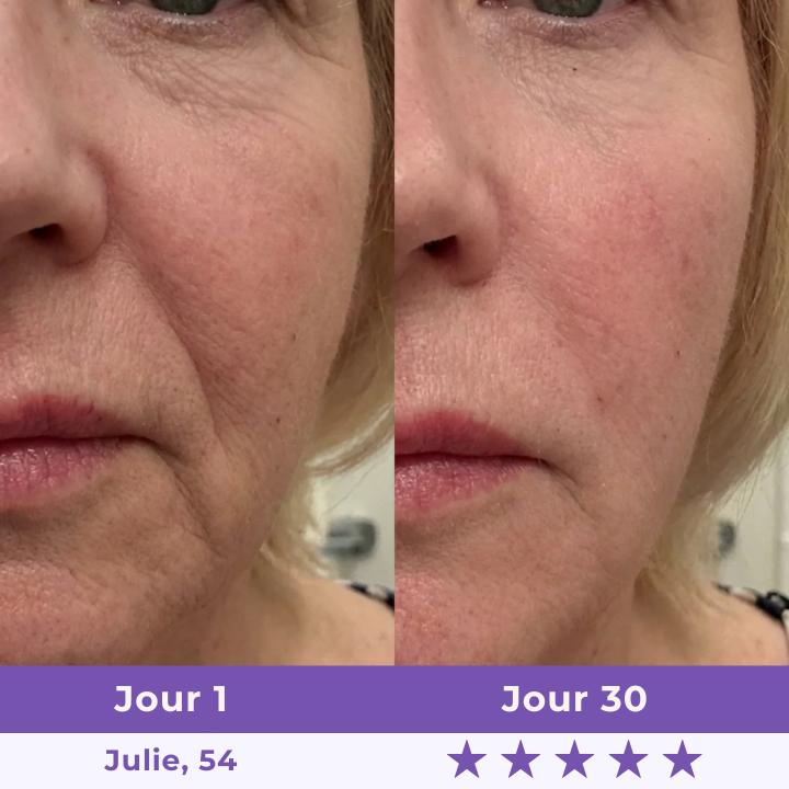 New Sculpteur Facial LED 7-en-1